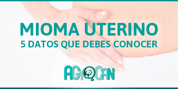 5 DATOS QUE DEBES CONOCER SOBRE EL MIOMA UTERINO