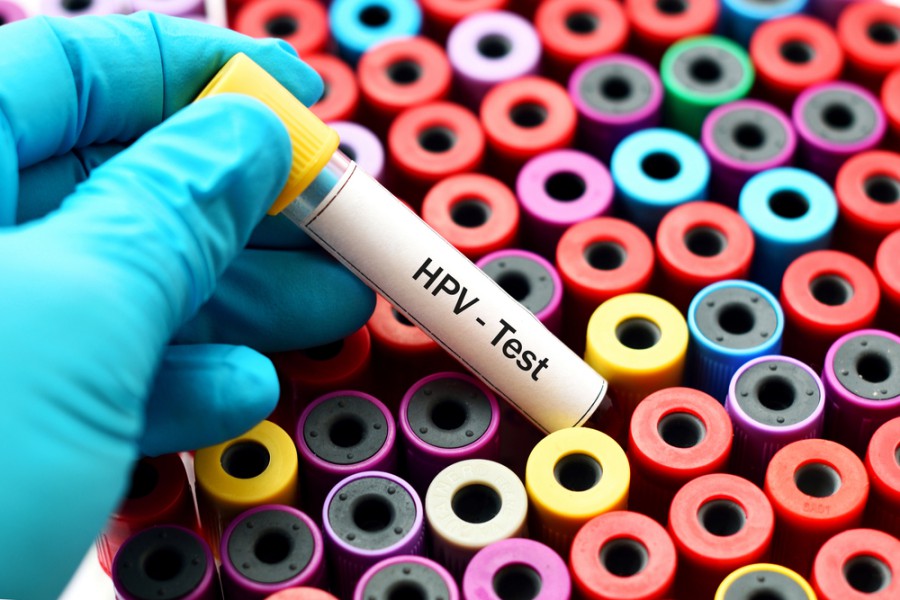 vacunación vph