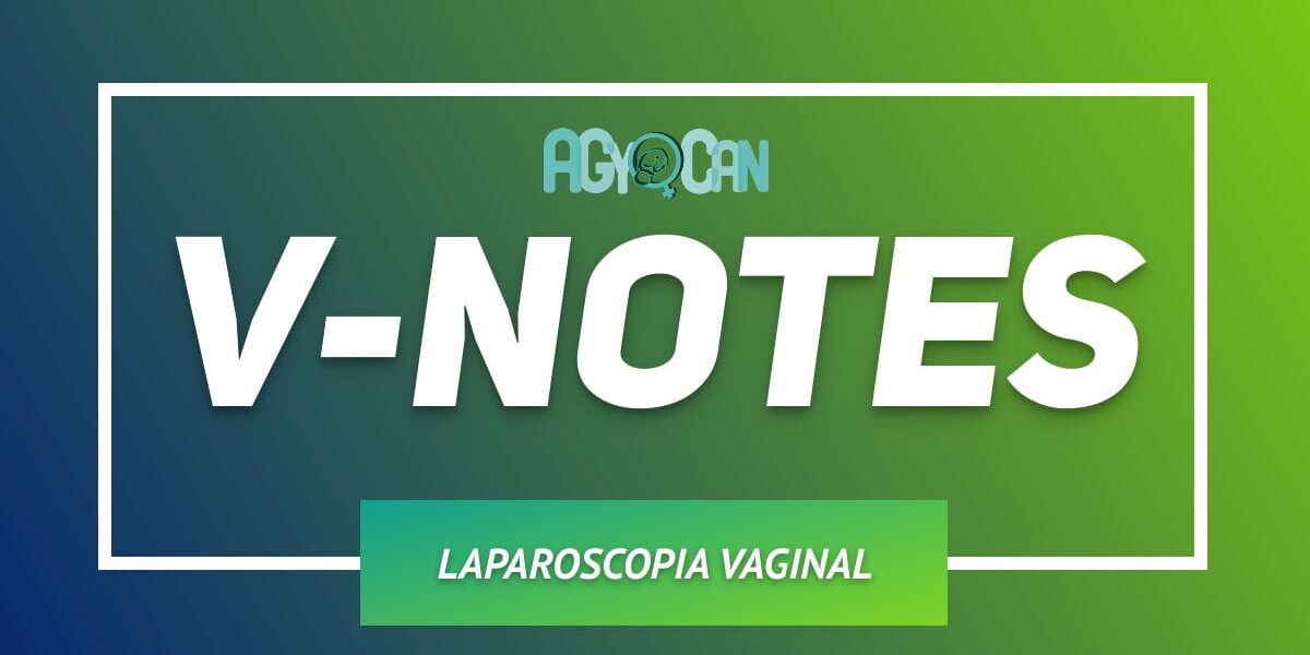 v notes